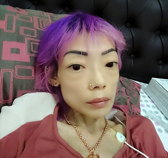 瘦成皮包骨,青筋凸出,9位脱相式衰老的女星,今昔对比差距大