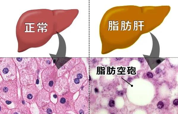 体检查出这19种疾病，医生：其实根本不用治！别再花冤枉钱