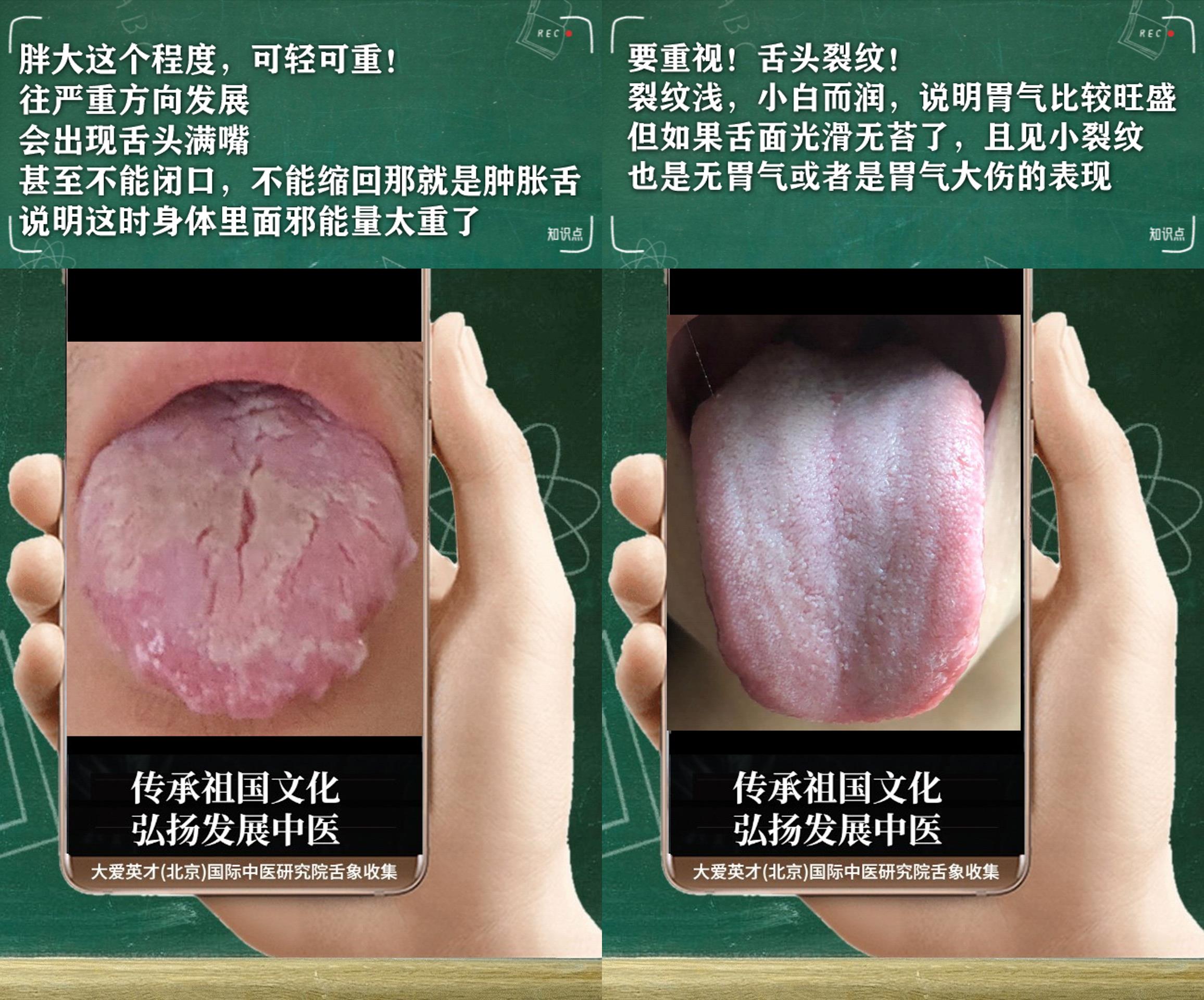 中医分析：憋屈、手足冰凉、鼻塞不通、反反复复很烦躁