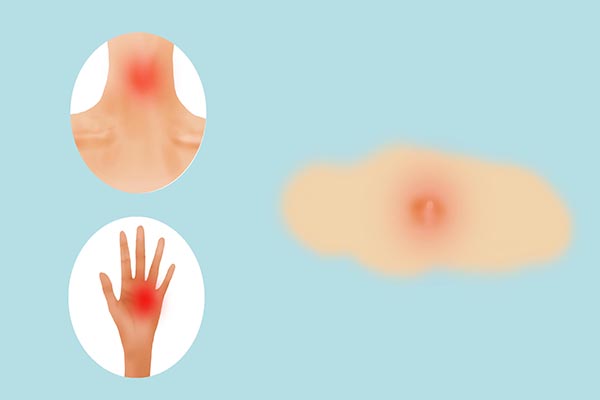 皮肤癌有哪些前兆？从皮肤看癌症，三种状况要警惕