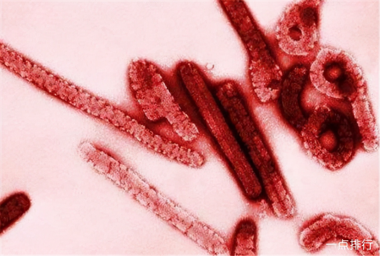 马尔堡病毒是埃博拉病毒的前身,都是在非洲某地区爆发,马尔堡病毒的