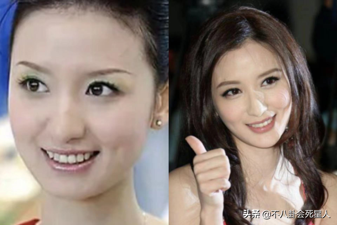 娱乐圈“假下巴”大赏，又尖又翘，一笑下巴原地起飞太吓人