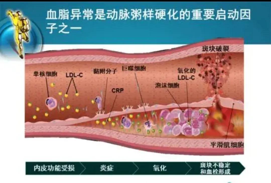红酒、鱼油会软化血管？保护血管要做好以下3点，血管健康更长寿