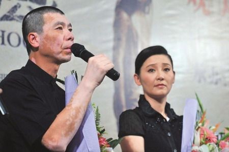 7位“被顽疾缠身”的明星，一个比一个有钱，却难逃病痛的折磨