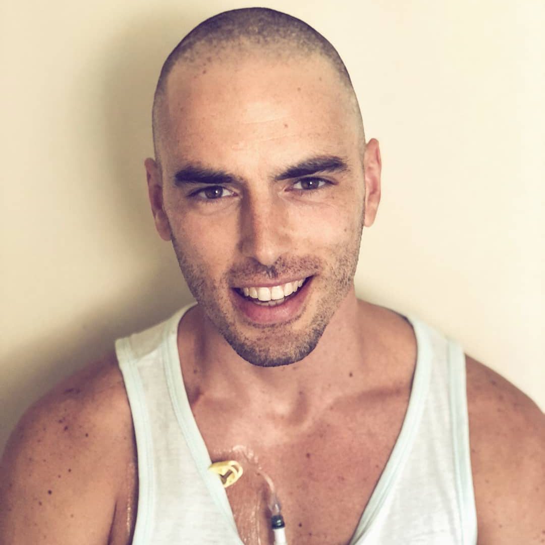 34岁西班牙男演员因淋巴癌去世，治疗期间将抗癌经历拍成电影