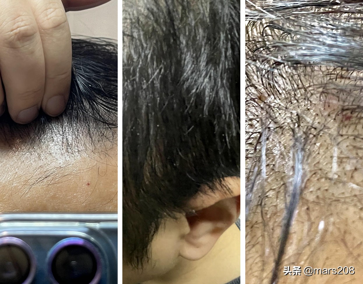 加班熬夜到头秃？6款防脱洗发水真实体验，告别油头，拯救秀发