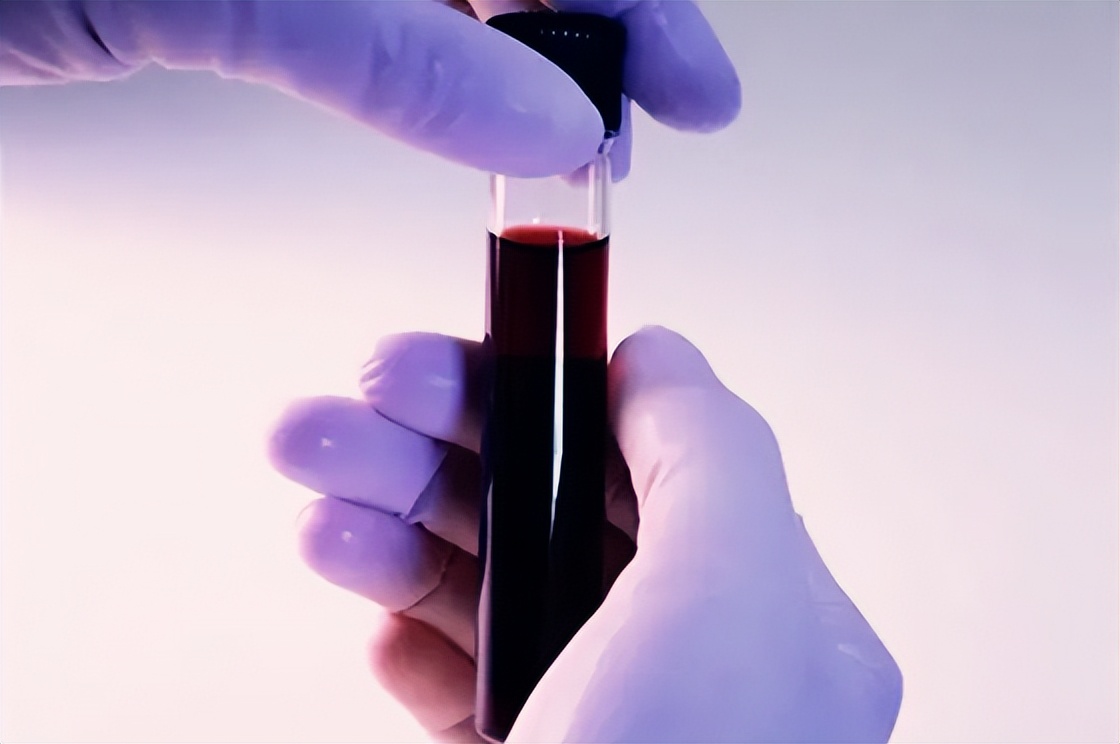 亚马逊现恶搞?买货竟收一剂“血”?TikTok、李嘉诚抢滩入局该市场