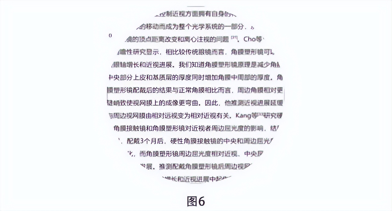 这台神秘的仪器有多厉害？兰州爱尔引进MRT（多光谱屈光地形图）