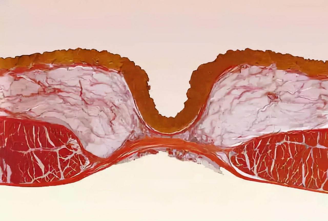 为什么不能乱抠肚脐眼？原来，肚脐眼连的根本不是肠子