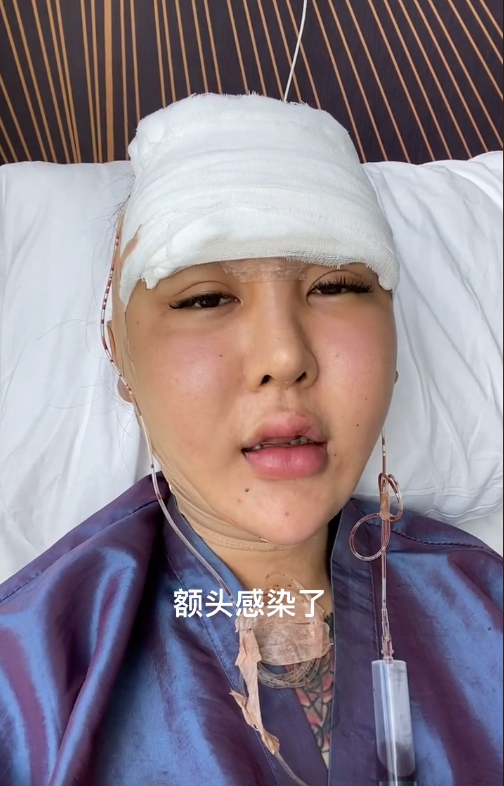 桃花宝宝:花百万"换头"失败,连亲妈都快认不出,她到底图啥?