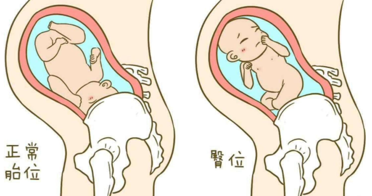 子宫内的羊水也非常充分,胎儿的活动范围也很大,自己想什么姿势就什么