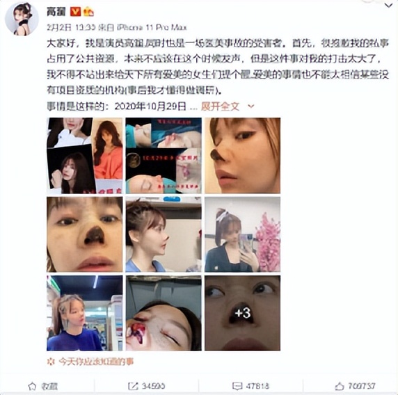 24岁女演员整容失败，让我想起了B站上听音乐美容的网友们