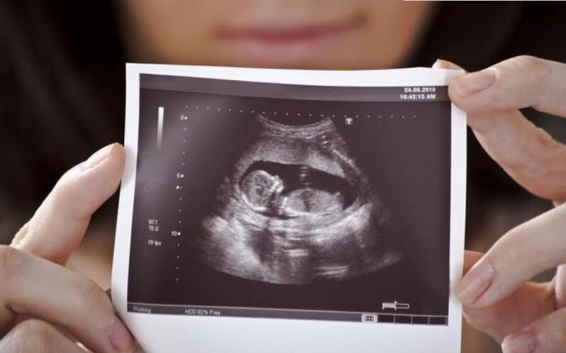 怀孕10周四维彩超图图片