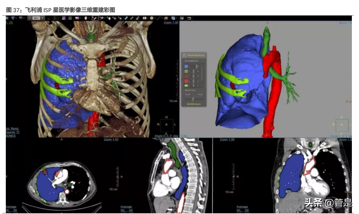 迈瑞医疗深度研究：“三瑞”系统构建智慧医疗生态圈