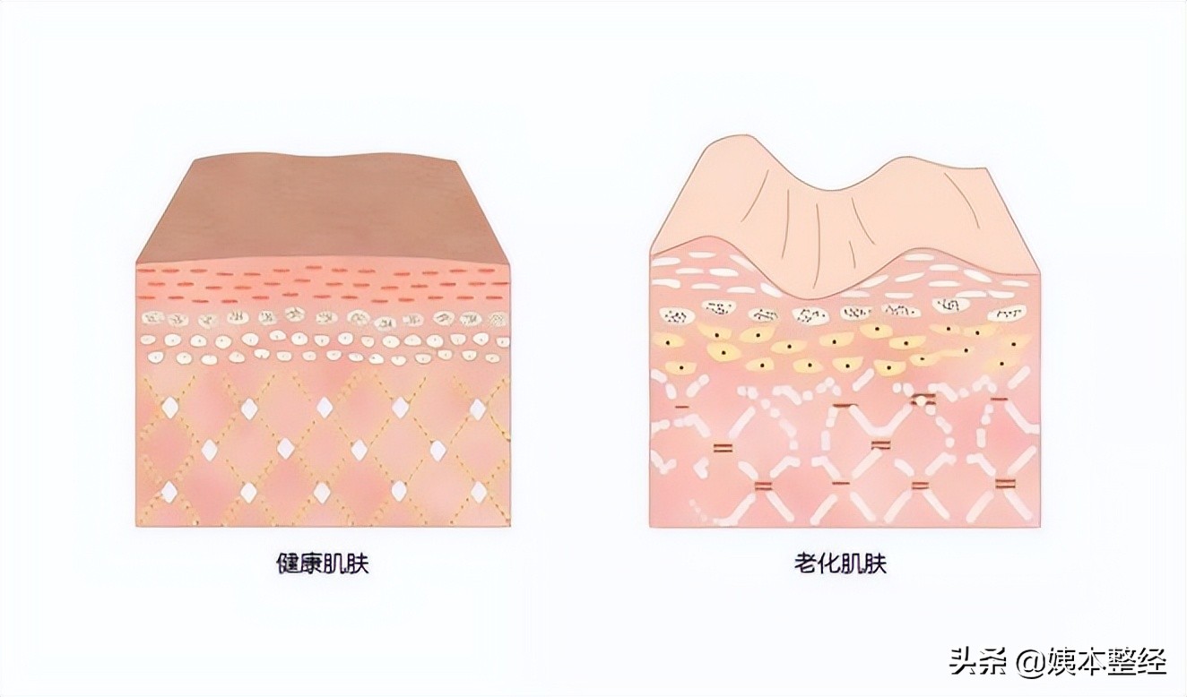 林允颜值变化史：高美商逆袭，堪称隐藏的骨相王者