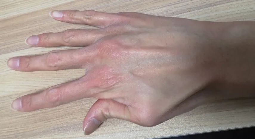 1米9的我常被当作山东大汉的代表，但我是得病了才又瘦又高的