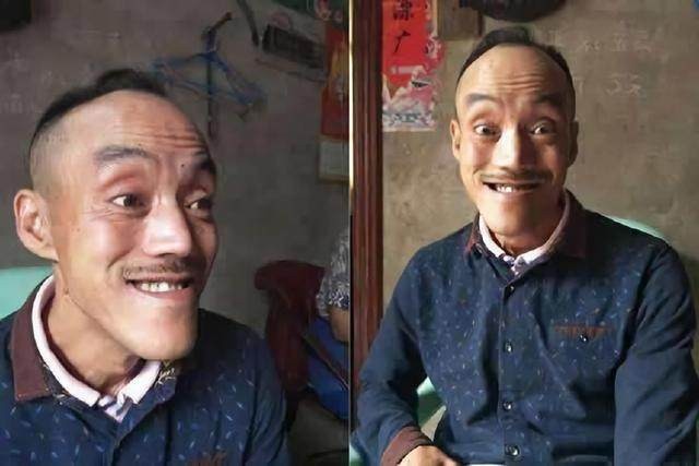 四川一老农因长得像光头强走红，开豪车拥娇妻，现在靠跑摩的为生