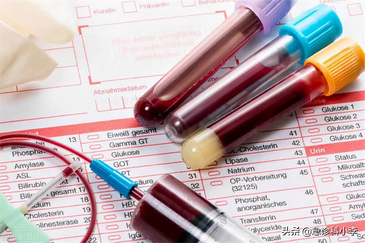 医生一步一步教您看血脂化验单，并不是有箭头就不正常