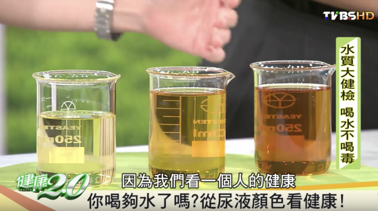 尿的颜色，能看出你得啥病？