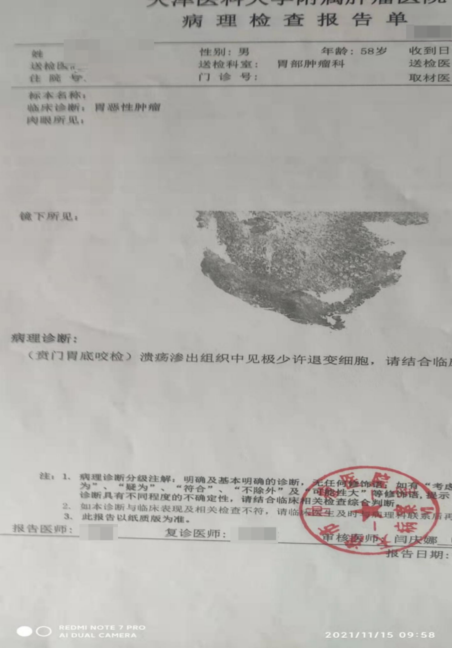 它是胃癌的罪魁祸首，一半中国人是阳性，却少有人重视