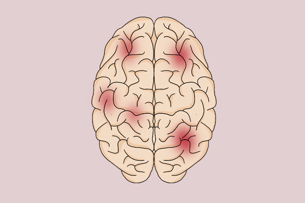 “地沟油”又来了？一饭店已卖5万锅！怎么识别地沟油？教你方法