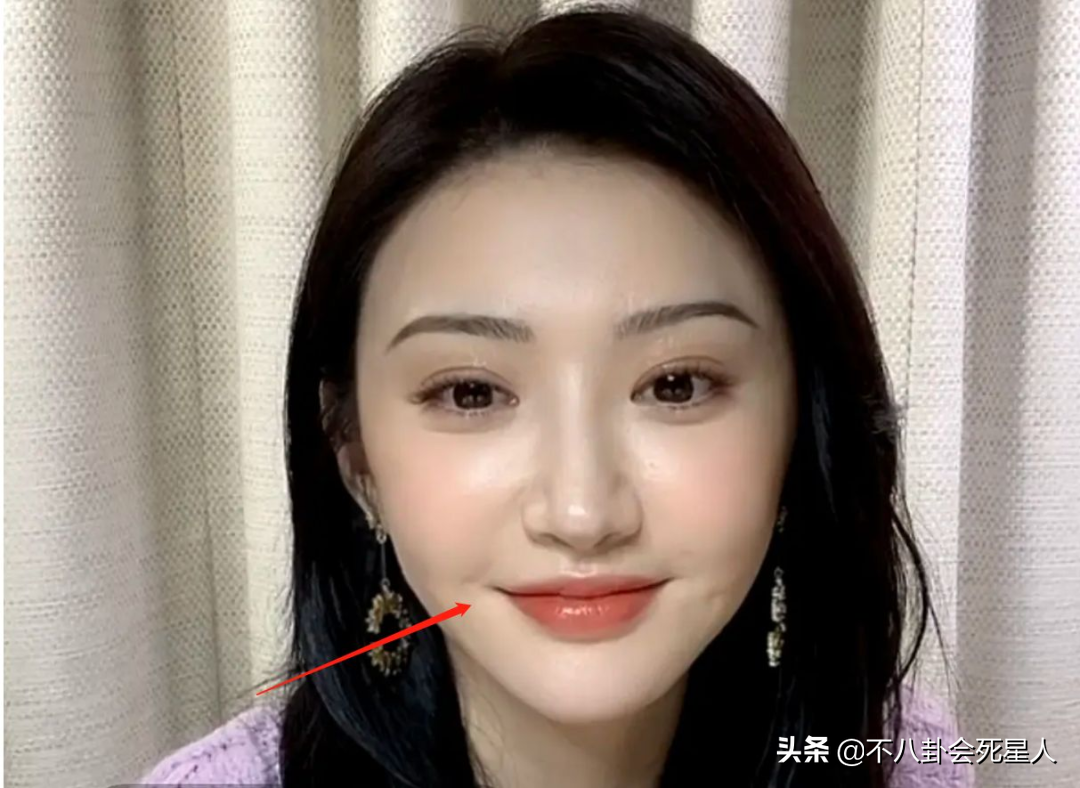 娱乐圈严重歪嘴的女星嘴有点歪的女星