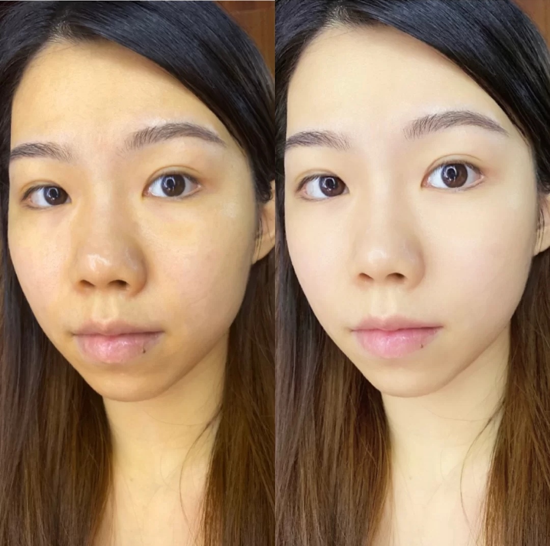 早C晚A这阵风你跟了吗？其一建立耐受，重在防反黑，不可操之过急