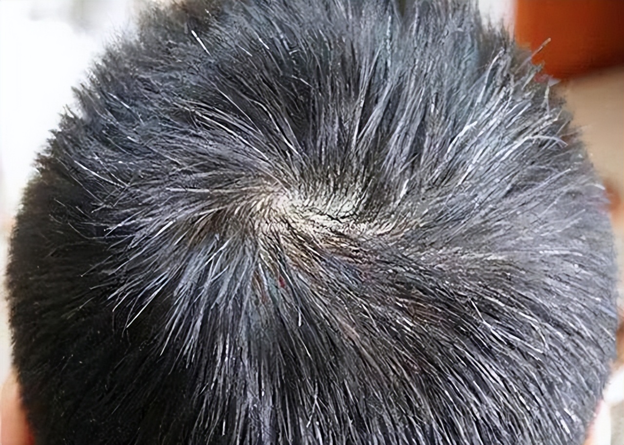 白发长在前额,两鬓,后脑勺,分别代表什么?看完涨知识了