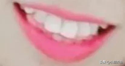 矫正牙齿的经历
