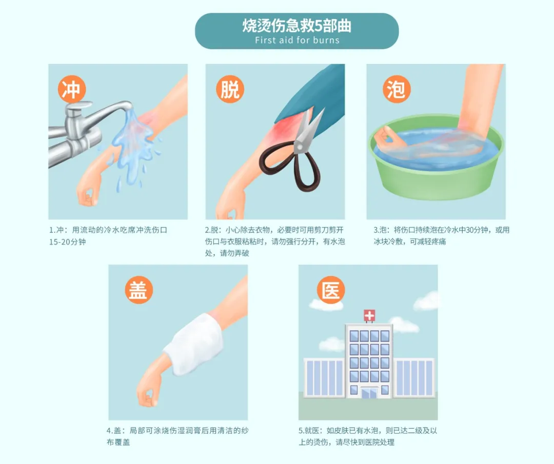 烧烫伤！如何紧急自救？