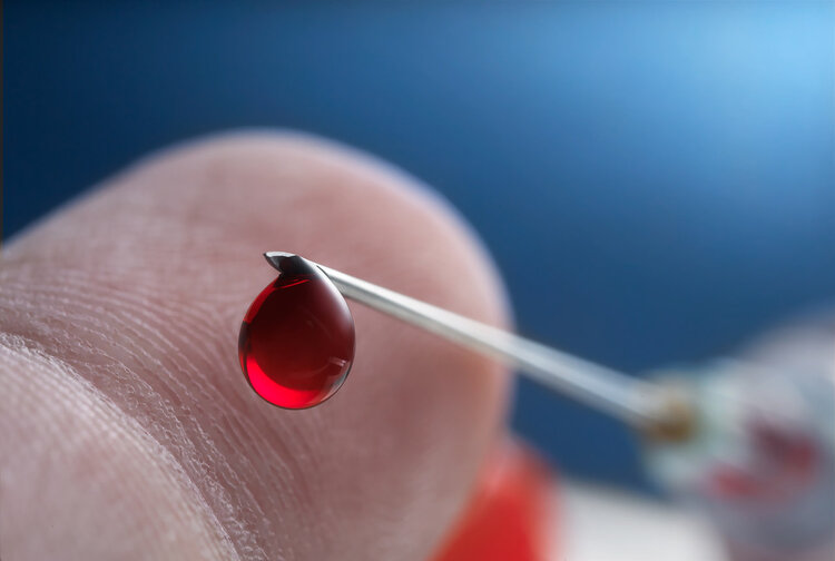 父亲O型血，母亲A型血，小女儿却是B型血？父亲的内心崩溃了