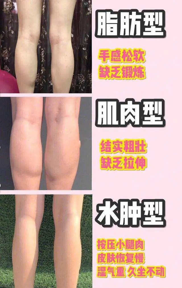 大腿变粗多半是这些原因，你踩雷了吗？