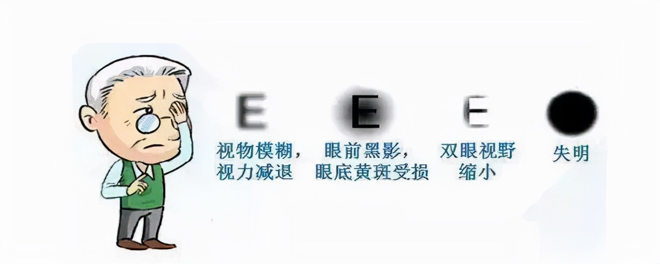 27岁男性眼睛出血，可能是糖尿病引起的！医生：糖友需警惕