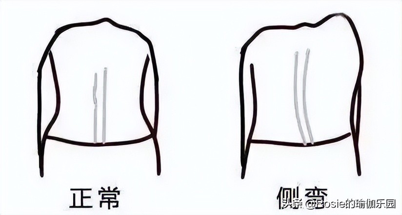 大S晒照美肩状态好，脊柱侧弯直角肩也不美，这样2步解锁好体态