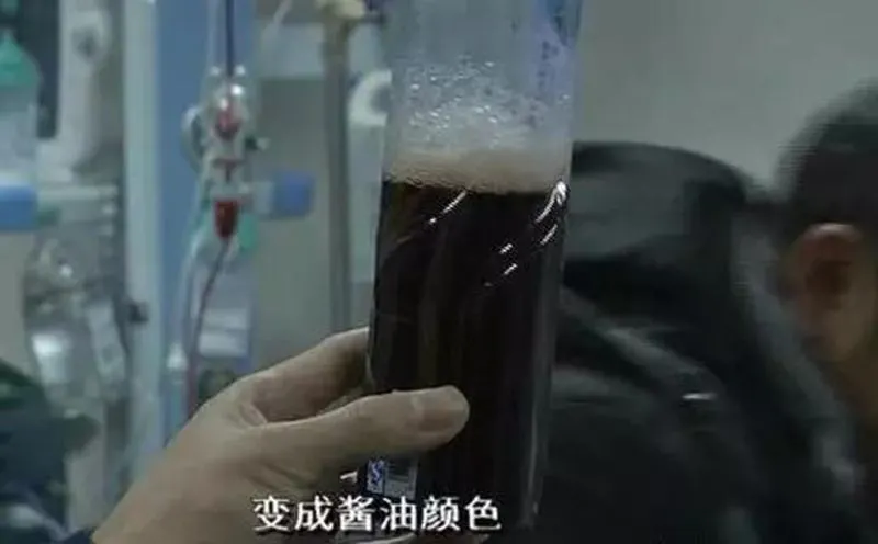 尿的颜色，能看出你得啥病？