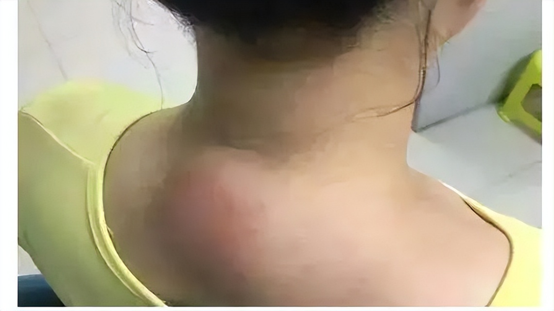 4招教你科学缓解