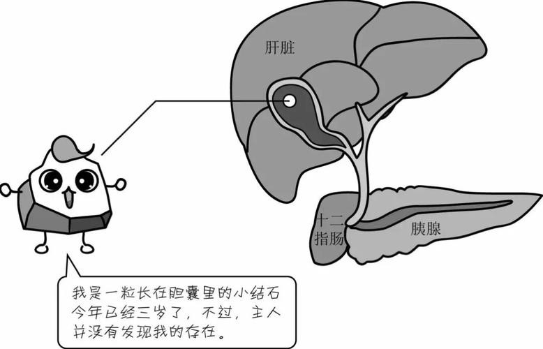 胆囊并非可有可无，切除后对身体有哪些影响？医生一文解释清楚