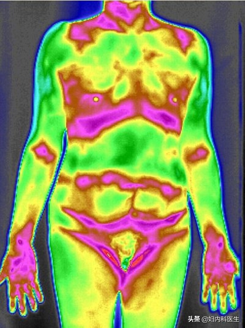 为啥有些医生喜欢建议患者做热成像检查？到底能检查出什么？