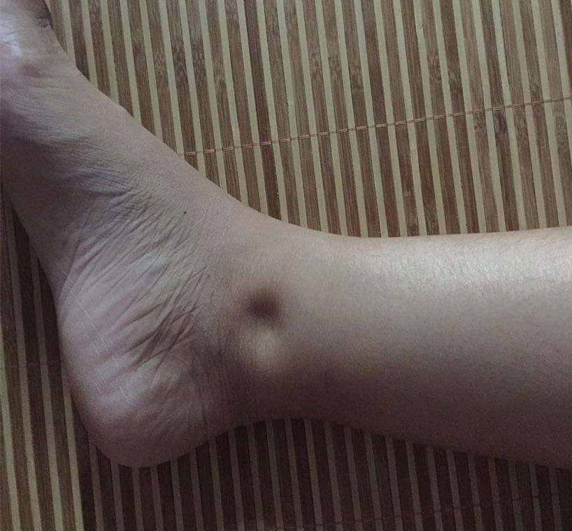 肾病跟哪些原因有关？高危人群有哪些？避免伤肾有哪些养护原则？