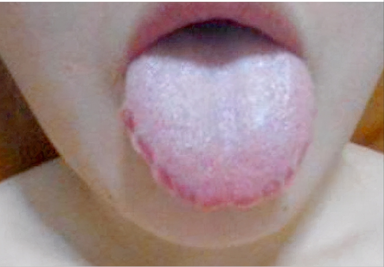 痰湿体质调理方法：健脾祛湿化痰食疗方案