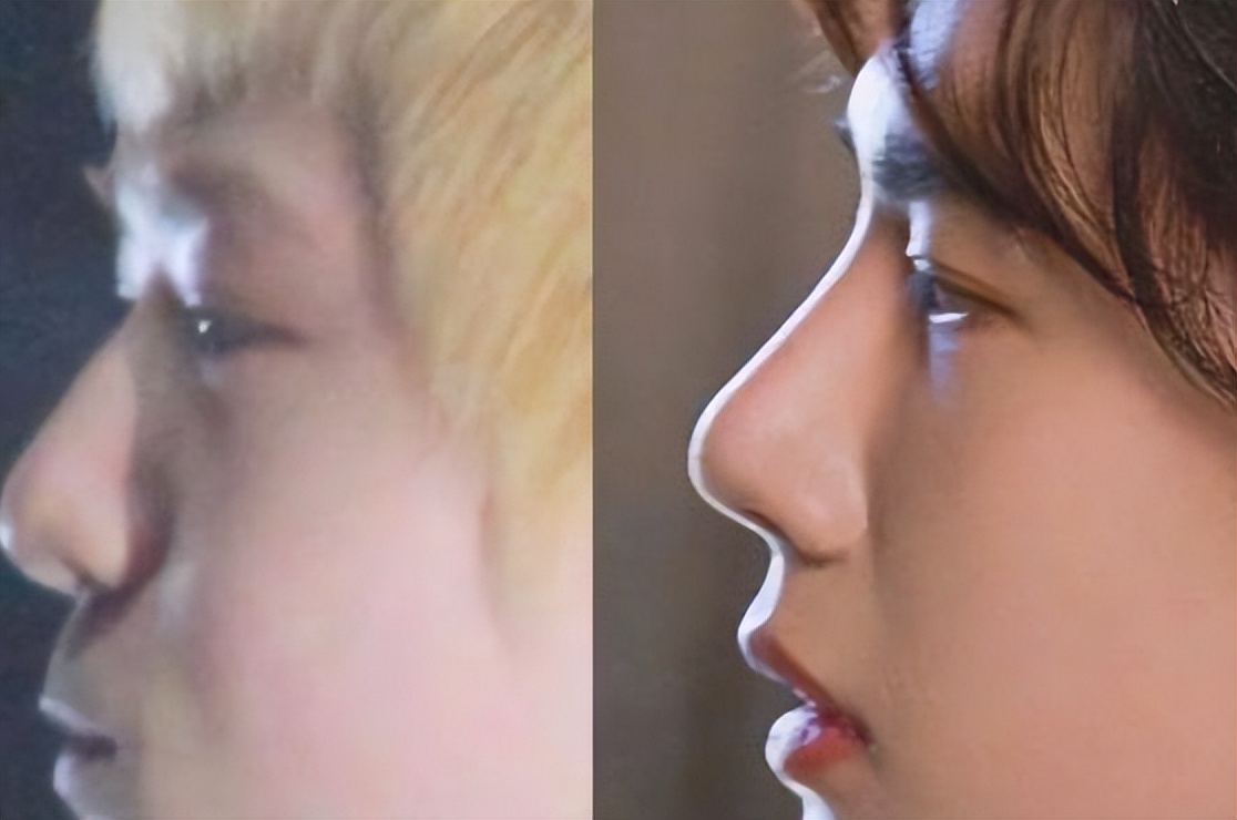 演艺圈“花式鼻子”大比拼，又尖又翘又吓人，一个比一个精彩