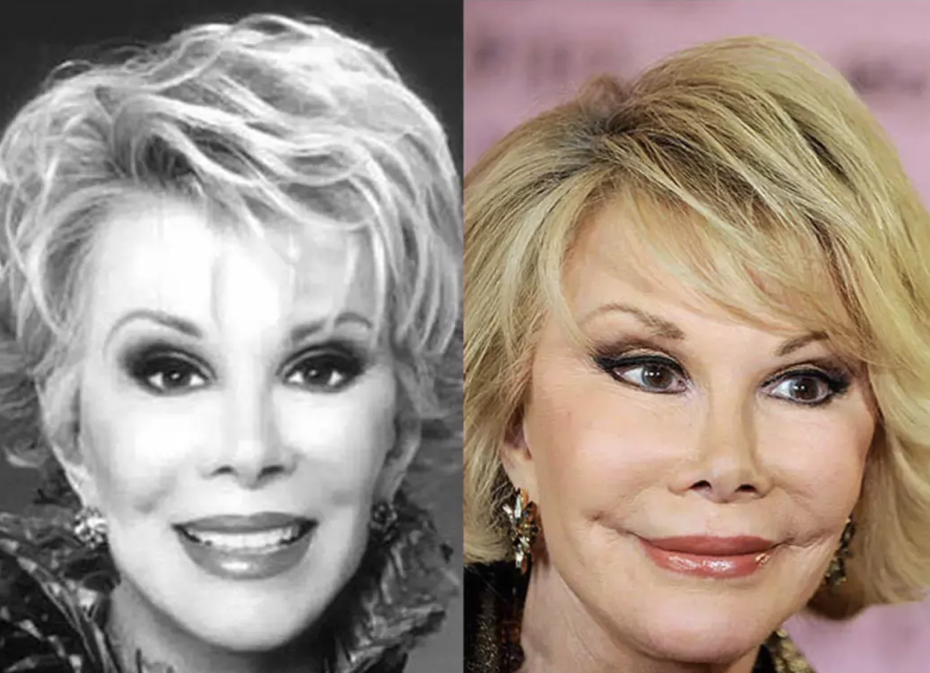 整容狂人乔斯林:嫁豪门失败,离婚分得25亿美元,如今怎么样了?