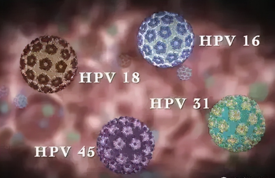 小孩扁平疣初期图片(hpv和病毒疣都啥模样)