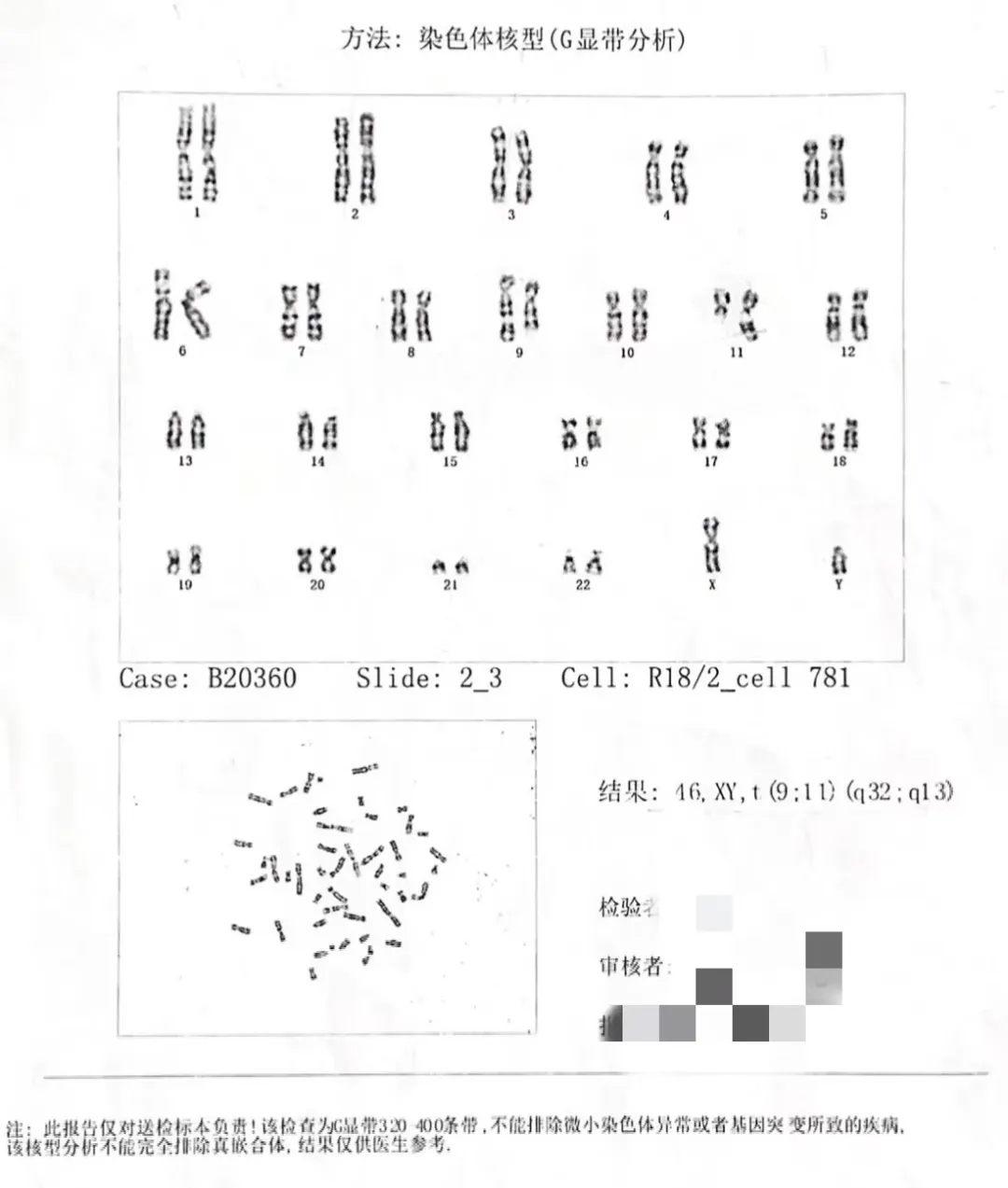 “孩子染色体一共有18种可能,其中只有1种完全正常”