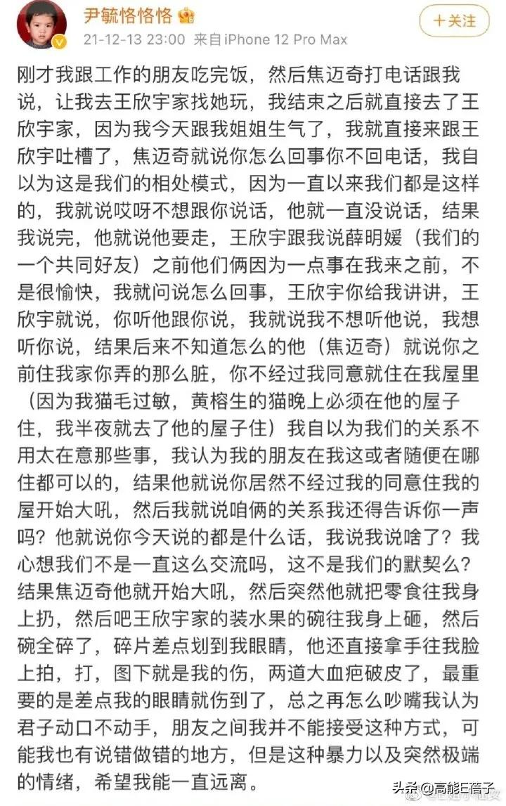 扯头花上热搜?但最没存在感的17快男全是宝藏