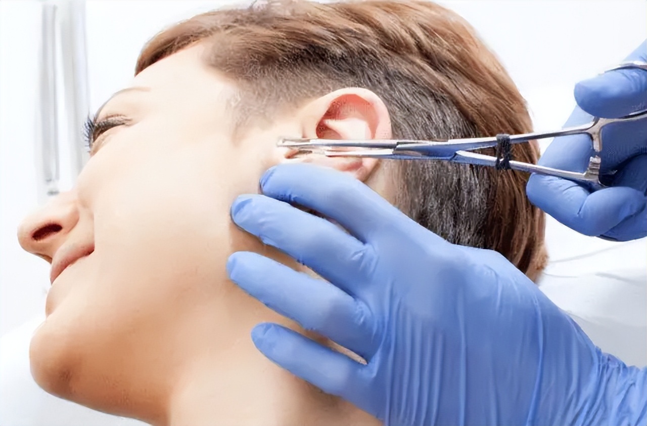 耳朵里面经常痒，想要动手挠？提醒：你要小心这2种异常现象了