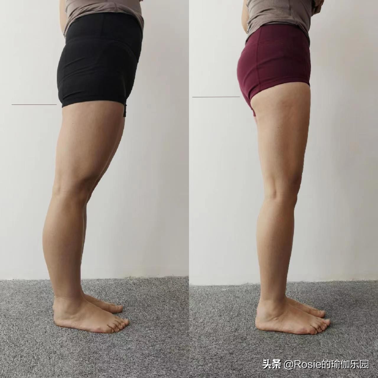 脚踝粗不自信，4步带你瘦腿瘦小脚踝，像阿雅一样自信成女王