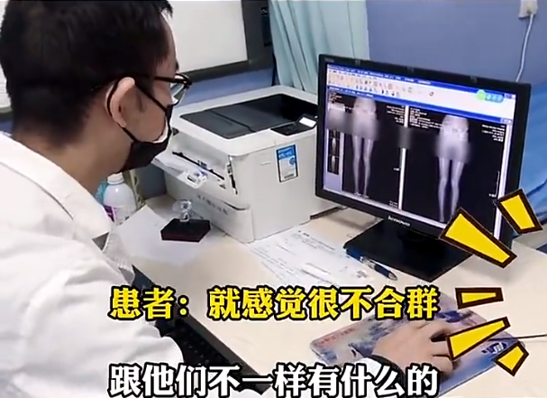 女大学生要求“截骨变矮”，竟是为了要“合群”，真实身高亮了