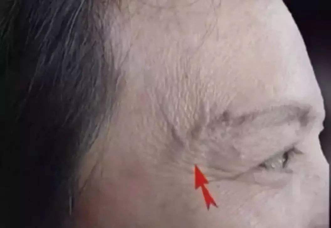 手上有很多青筋凸起，是因为毒素积累导致的吗？看看不一样的说法