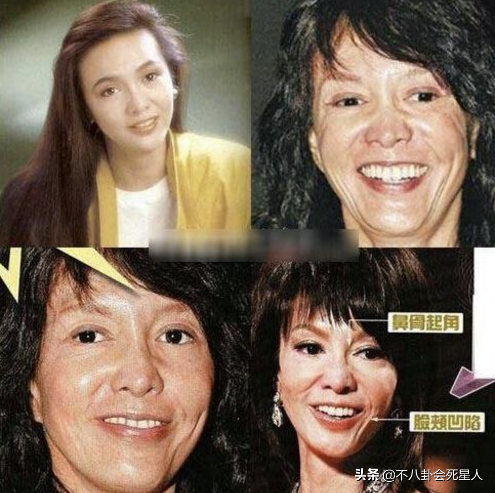 娱乐圈“假下巴”大赏，又尖又翘，一笑下巴原地起飞太吓人